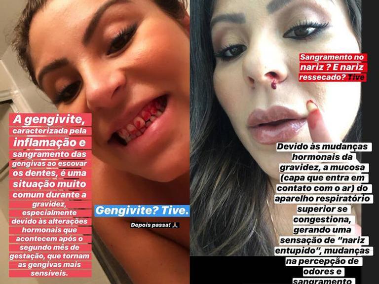 Andressa Ferreira mostra sangramentos