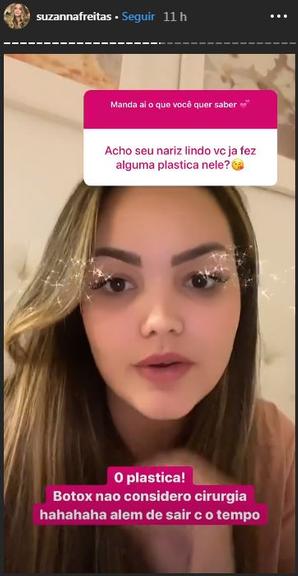 Suzanna Freitas revela que já fez botox, silicone e preenchimento