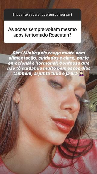 Flavia Pavanelli mostra pele com acnes e fala sobre alimentação: ''Não tô cuidando''