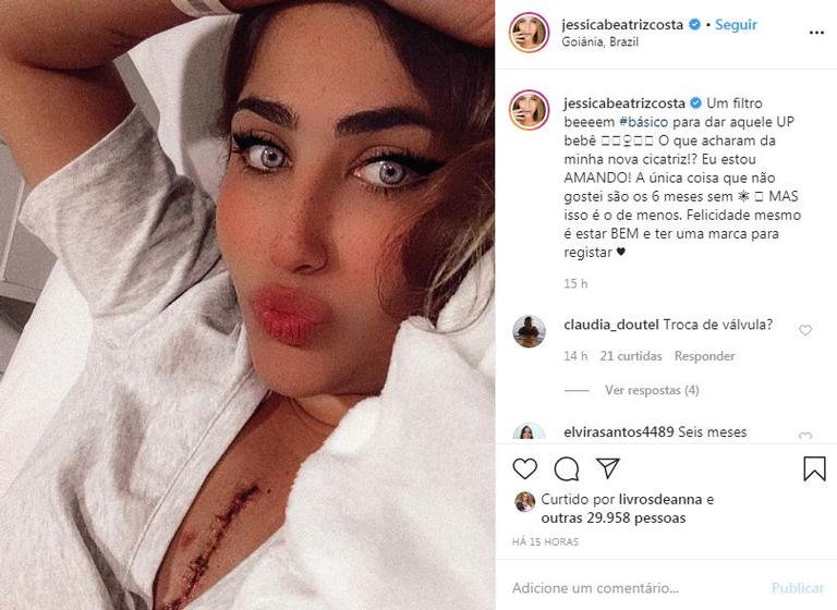 Jessica Costa mostra cicatriz de cirurgia no coração