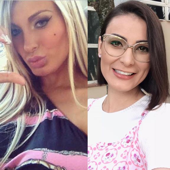 Andressa Urach mostra antes e depois