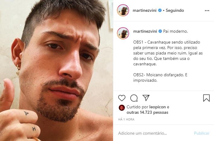 Vinicius Martinez aparece com cavanhaque e fãs aprovam