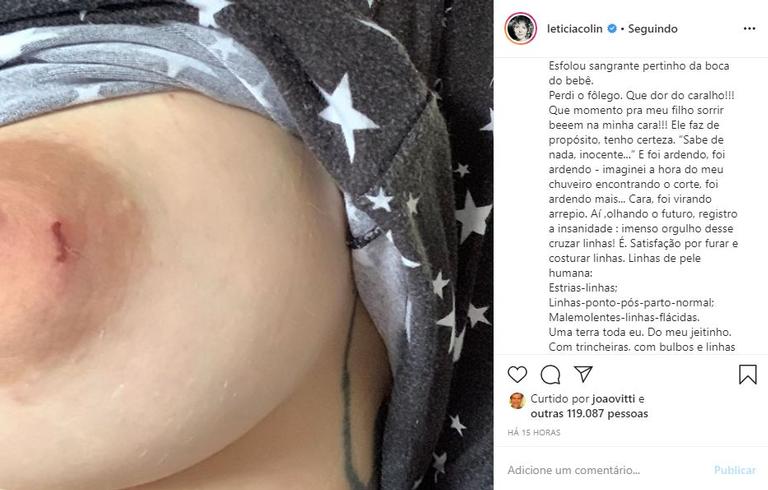 Leticia Colin mostra mamilo machucado após amamentar