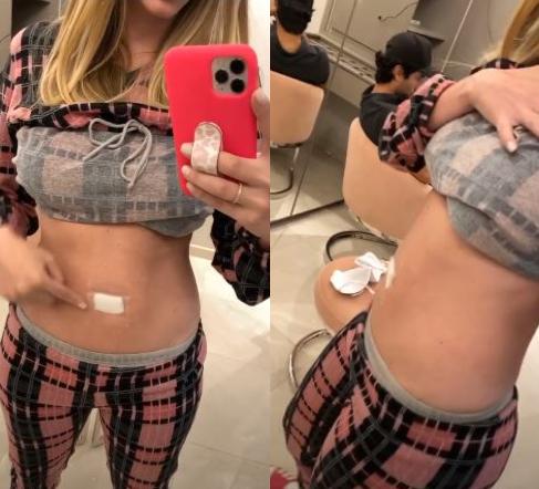 Bárbara Evans exibe inchaço no corpo após cirurgia 