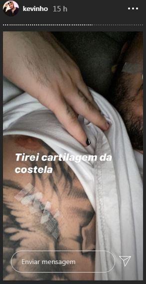 Kevinho mostra antes e depois de cirurgia no nariz