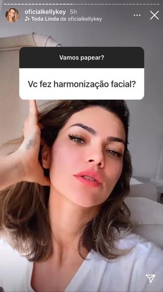 Kelly Key sobre harmonização facial