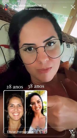 Graciele Lacerda antes e depois de suas bochechas