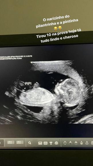 Whindersson Nunes se derrete com o ultrassom do filho