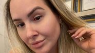 Patrícia Leitte fala sobre seu derrame ocular - Reprodução/Instagram