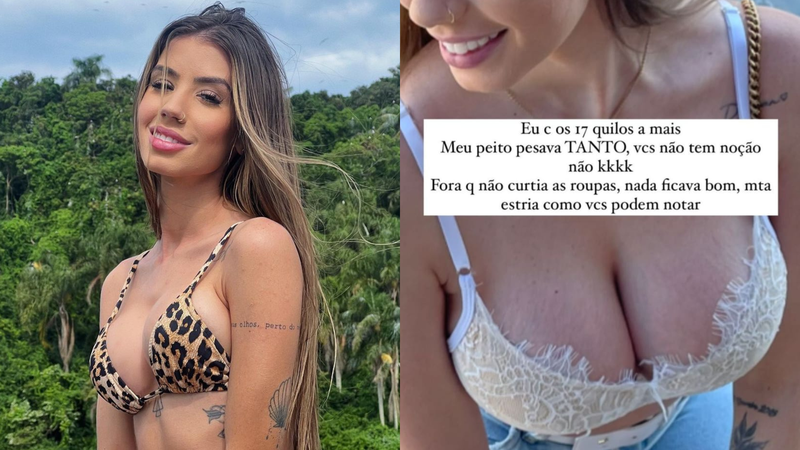 Maria Lina mostra antes de depois de cirurgia plástica - Foto: Reprodução/Instagram