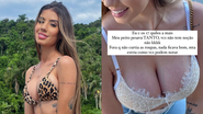 Maria Lina mostra antes de depois de cirurgia plástica - Foto: Reprodução/Instagram