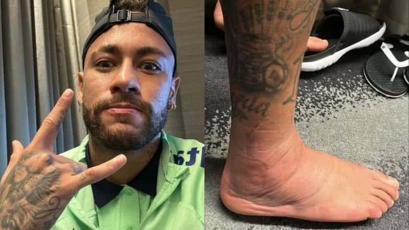 Neymar mostra tornozelo durante tratamento contra lesão - Reprodução/Instagram