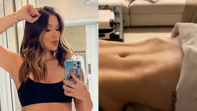 Virgínia Fonseca choca com barriga chapada após drenagem - Reprodução/Instagram