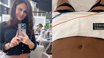 Viviane Araújo mostra tratamento na barriga após o nascimento de Joaquim - Reprodução/Instagram