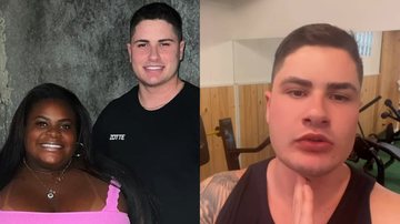 Marido de Jojo Todynho mostra resultado de preenchimento facial - Reprodução/Instagram