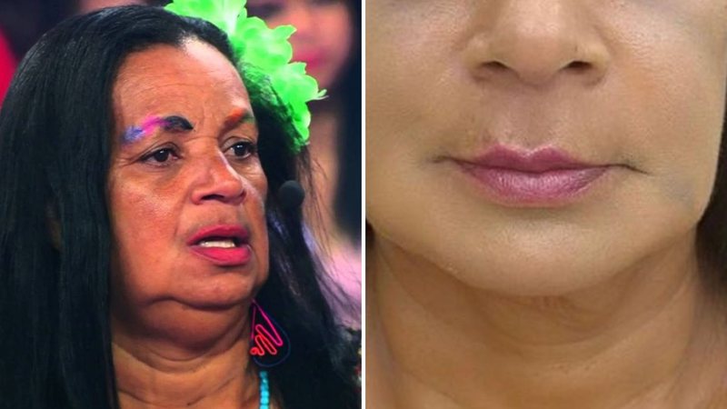 Gaguinha de Ilhéus faz harmonização facial - Reprodução/ Instagram