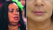 Gaguinha de Ilhéus faz harmonização facial - Reprodução/ Instagram