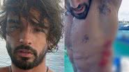 Marlon Teixeira sofre acidente de surf - Reprodução/Instagram