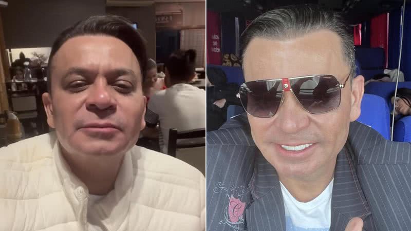 Frank Aguiar aparece nos stories do Instagram após harmonização facial e novo corte de cabelo - Foto: Reprodução / Instagram