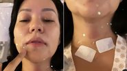 Geovanna Tominaga passa por cirurgia para remover tumor benigno - Foto: Reprodução / Instagram