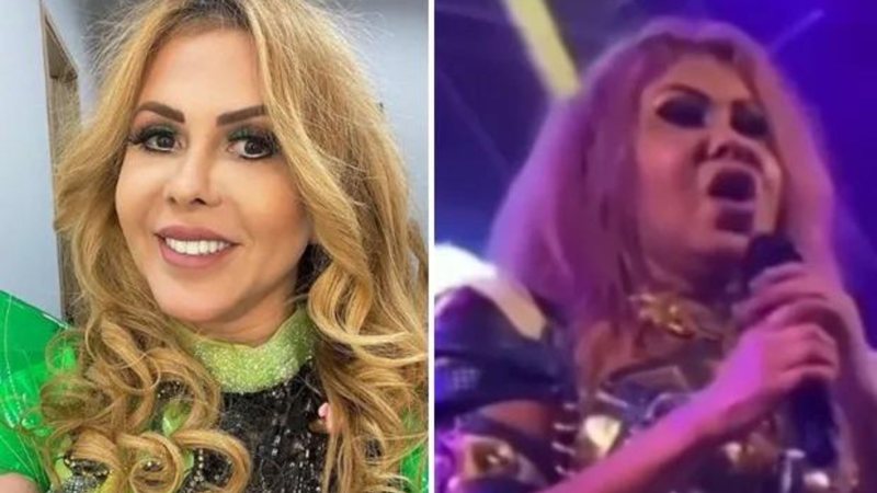 Sinusite bacteriana: como será o tratamento de Joelma após diagnóstico clínico - Reprodução/ Instagram