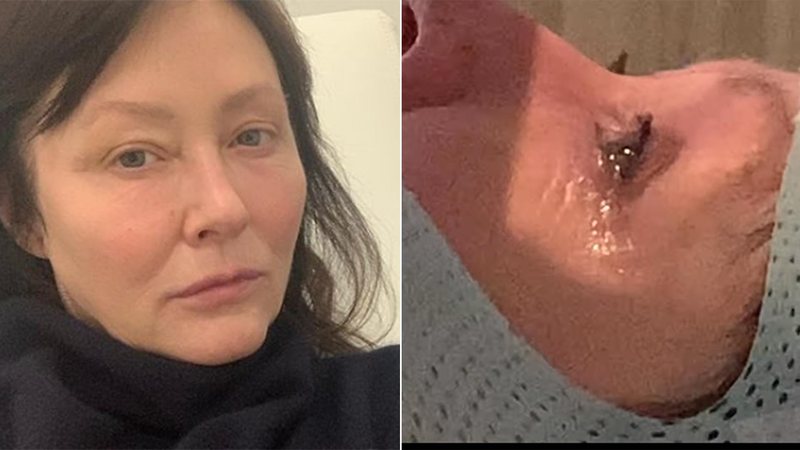 Atriz de Barrados no Baile, Shannen Doherty revela que o câncer chegou ao seu cérebro - Foto: Reprodução / Instagram