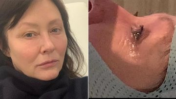 Atriz de Barrados no Baile, Shannen Doherty revela que o câncer chegou ao seu cérebro - Foto: Reprodução / Instagram