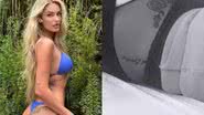 Yasmin Brunet faz procedimento estético no bumbum - Reprodução/Instagram