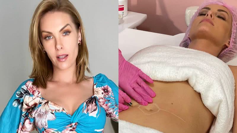 Ana Hickmann realiza procedimento estético na barriga - Reprodução/Instagram