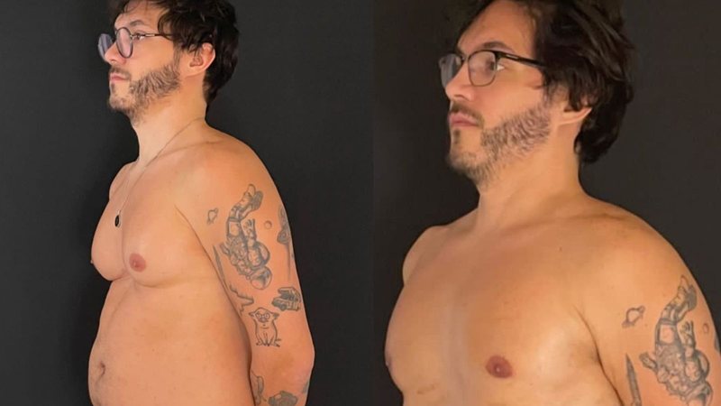 Eliezer impressiona ao exibir resultado de lipoaspiração e redução das mamas - Reprodução/Instagram