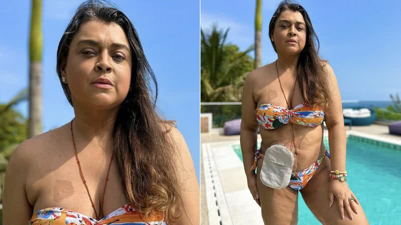 Preta Gil mostra sua bolsa de ileostomia - Foto: Reprodução / Instagram