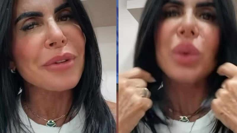 Gretchen passa por cirurgia de retirada do útero - Reprodução/Instagram