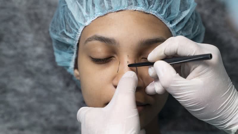 Rinoplastia está entre as cirurgias plásticas mais populares do Brasil - Foto: Freepik