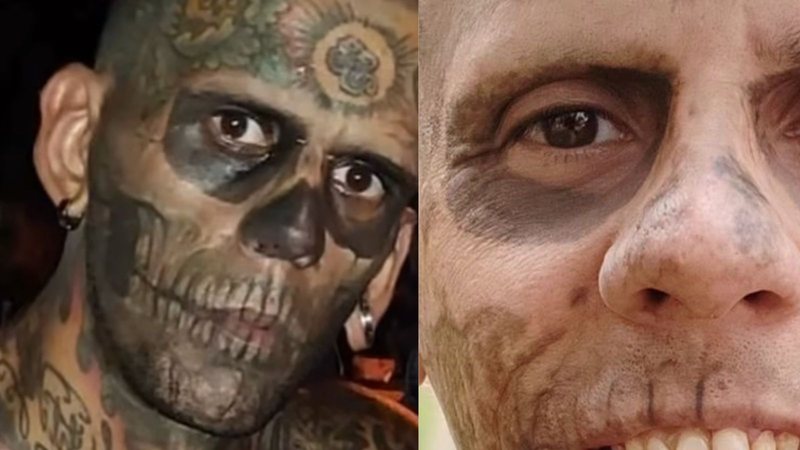 Homem mais tatuado do Brasil decide remover tatuagens - Reprodução/Instagram