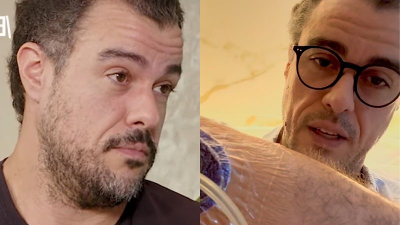 Joaquim Lopes revela detalhes após passar por cirurgia no braço - Reprodução/Instagram/YouTube