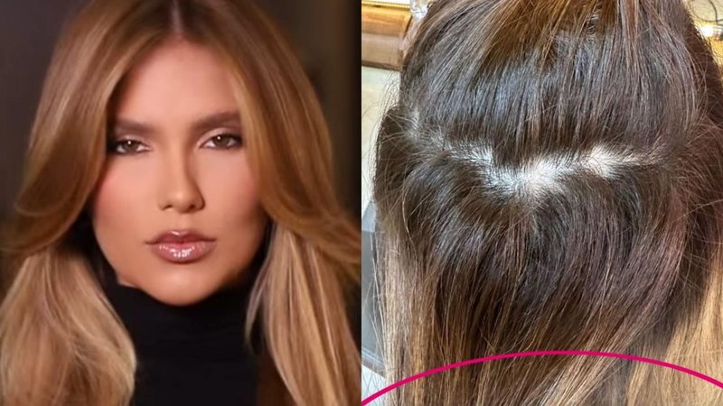 Virginia fala sobre queda de cabelo após revelar novo visual - Reprodução/Instagram/Luis Felipe