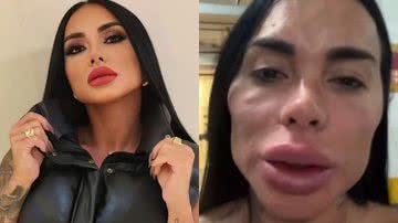 Kamila Simione antes e depois da harmonização facial - Reprodução/Instagram