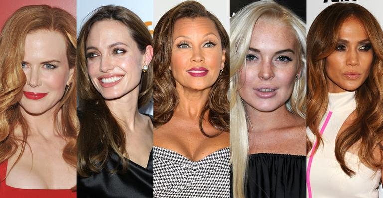 Veja os famosos de Hollywood que aplicaram botox - Getty Images