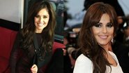 Cheryl Cole posa com tipoia - Getty Images