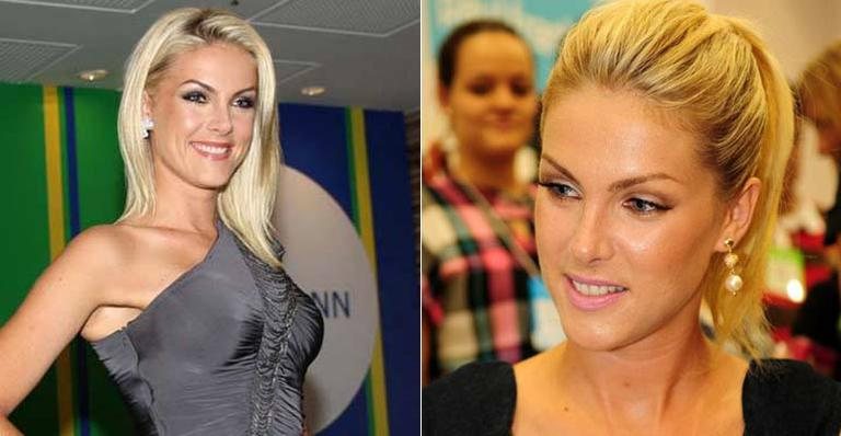 Ana Hickmann - Arquivo CARAS