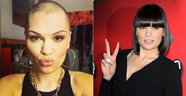 Jessie J está careca - Reprodução / Instagram / Getty Images