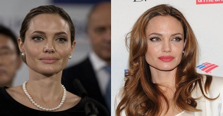 Angelina Jolie anunciou a realização do procedimento cirúrgico intitulado "mastectomia dupla" no último dia 14 - Getty Images/Foto montagem