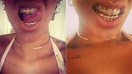 Rihanna coloca grillz nos dentes - Instagram/Reprodução