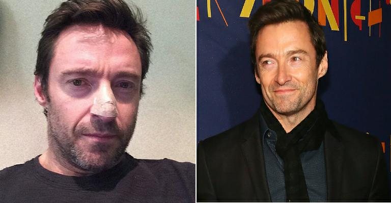 Hugh Jackman - Reprodução / Hugh Jackman / Instagram e Getty Images