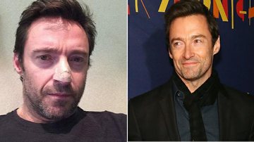 Hugh Jackman - Reprodução / Hugh Jackman / Instagram e Getty Images