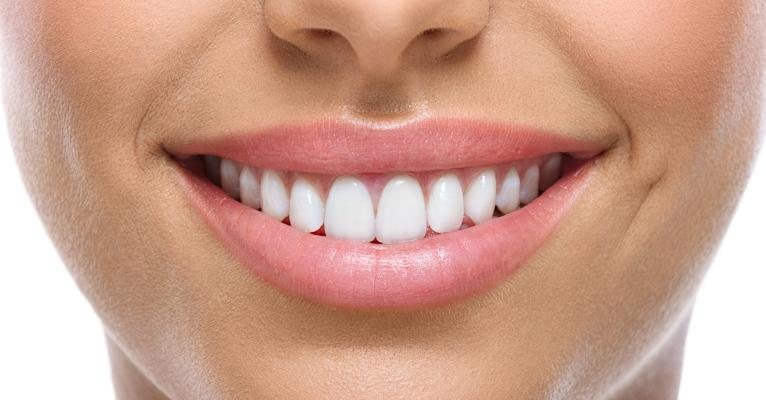 Sorriso perfeito - Shutterstock