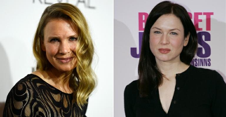 Renée Zellweger exagera no botox e surge irreconhecível em evento - Getty Images