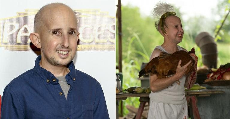 Ben Woolf - Getty Images e Divulgação