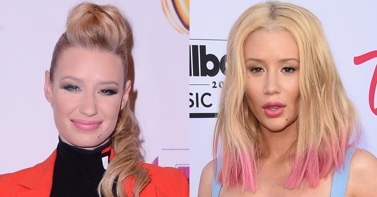 Iggy Azalea antes e depois - Getty Images