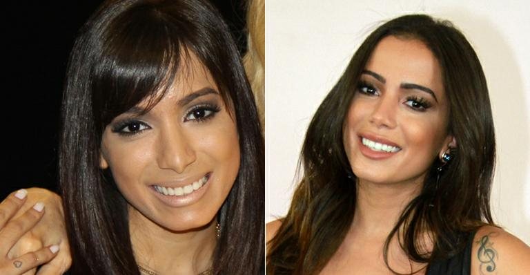 Anitta rinoplastia - Carol Soares/SBT; Graça Paes/ Brazil News